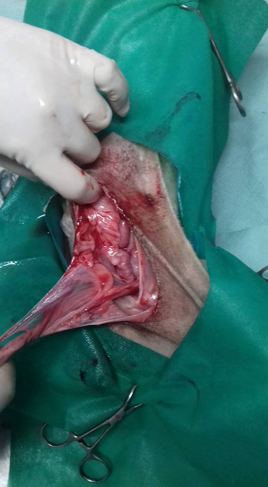 Cazul Toaca hernie inghinală hematom hemitoracele drept