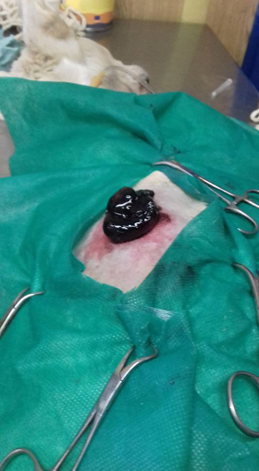 Cazul Toaca hernie inghinală hematom hemitoracele drept